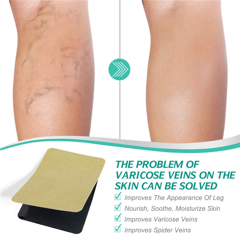 Varicose Veins Patch for Soothing Leg Fatigue Leg Pain Relief